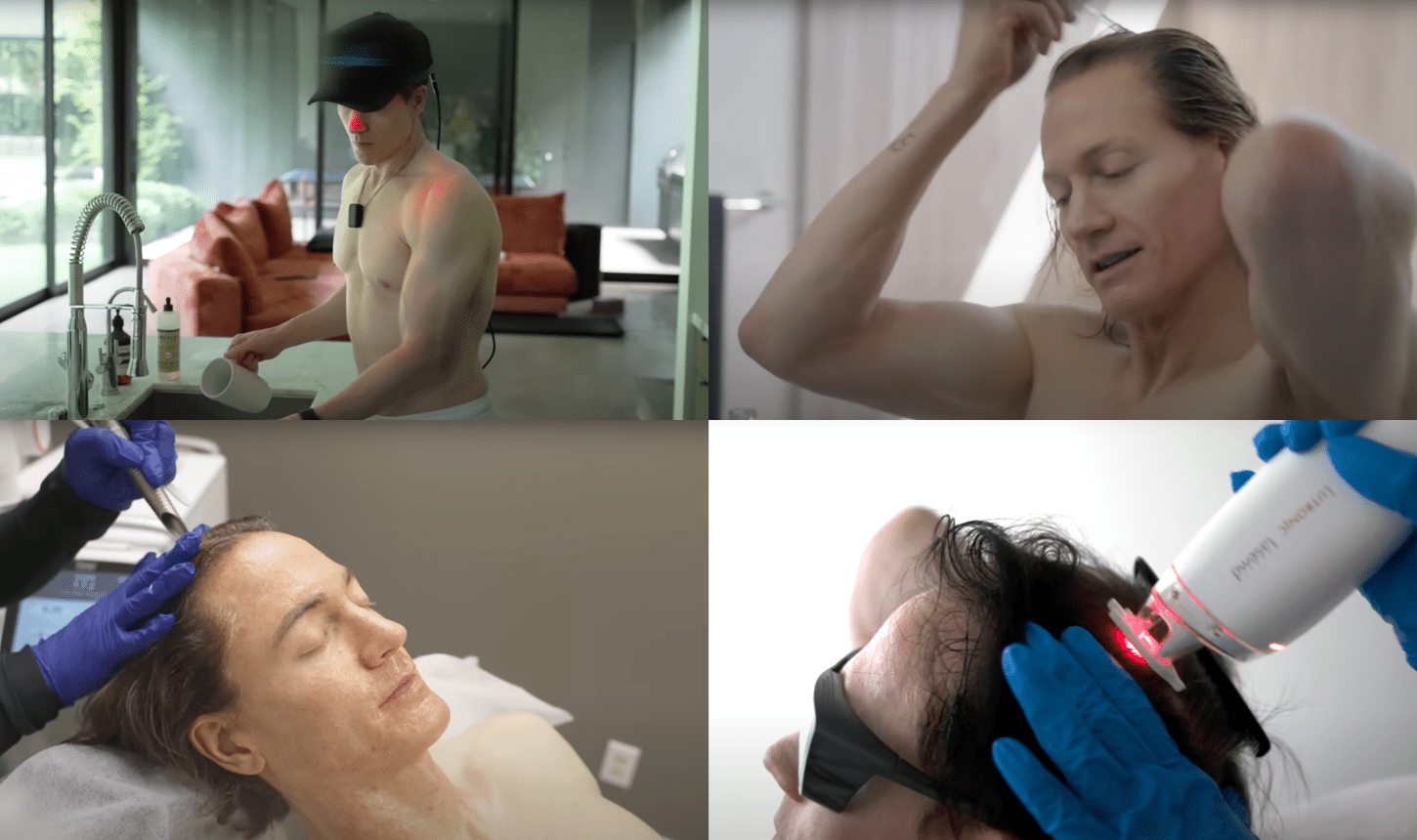 How I Reversed My Hair Loss