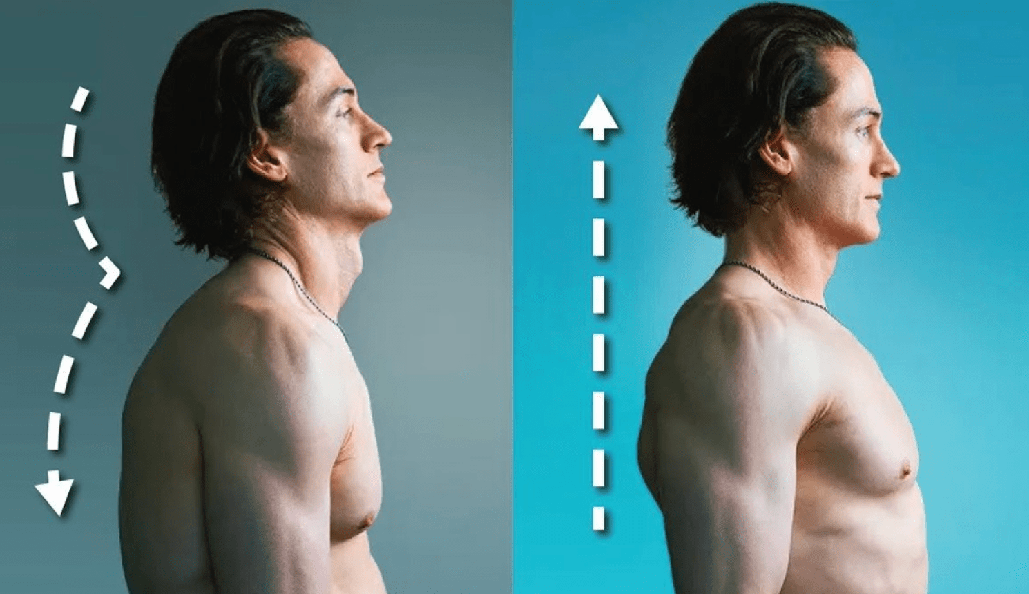 How I Fixed My Terrible Posture - 5 Habits