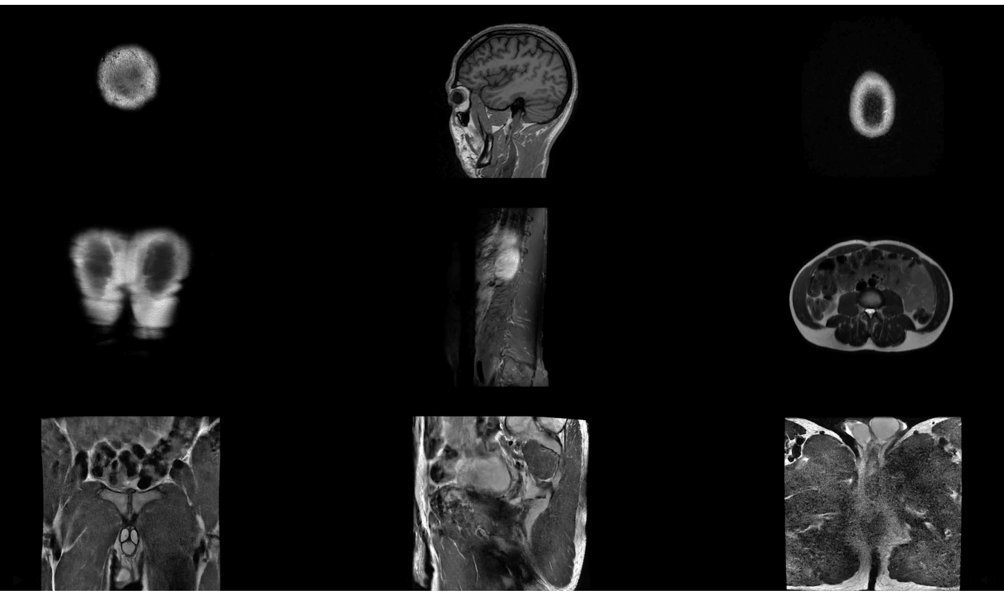The World's Best MRI Protocol