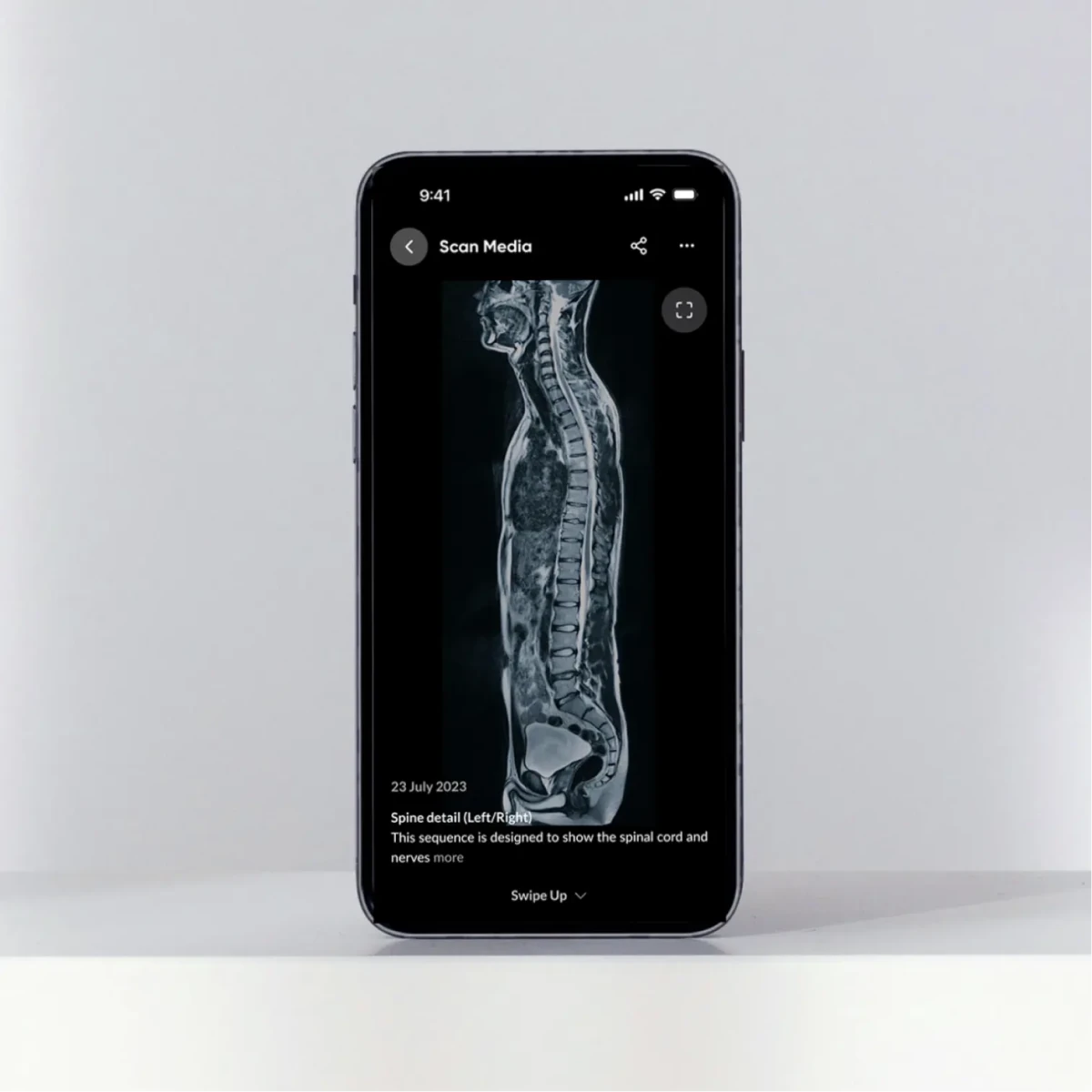 Phone displaying a full-body MRI scan from a Blueprint longevity health screening