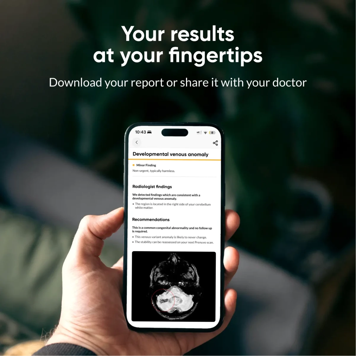 Hand holding a phone with a whole-body MRI report to download or share with your doctor